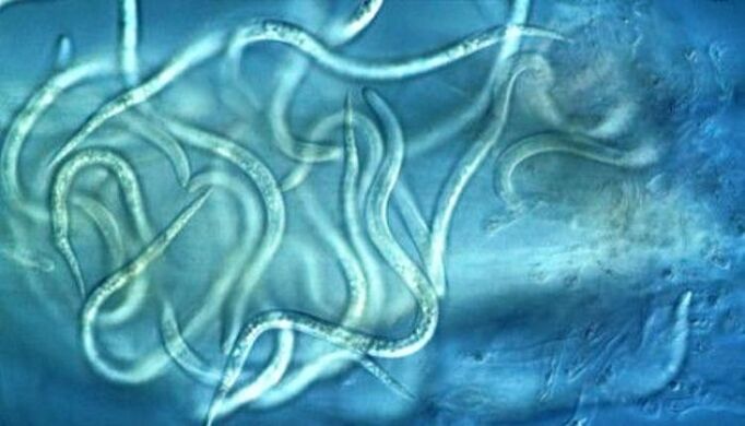 cum arată paraziții nematode în corpul uman